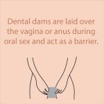 A graphic for the usage of Dental Dams.