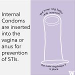 A graphic for usage of Internal Condom.